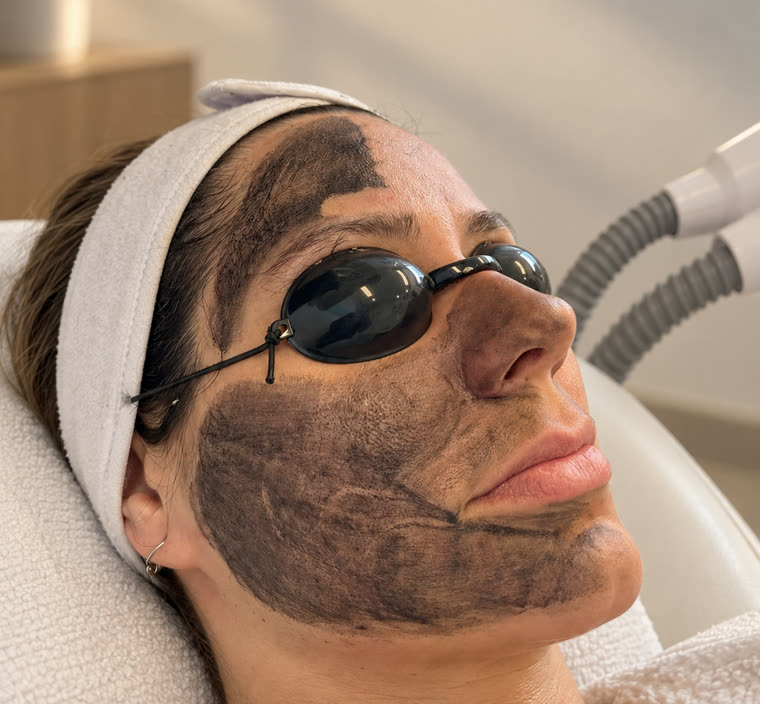 Hollywood Peeling för ansikte och hals